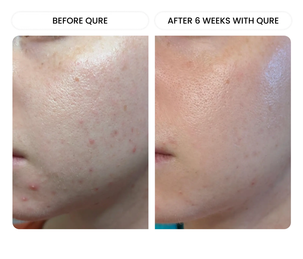 All-In-One Face Serum