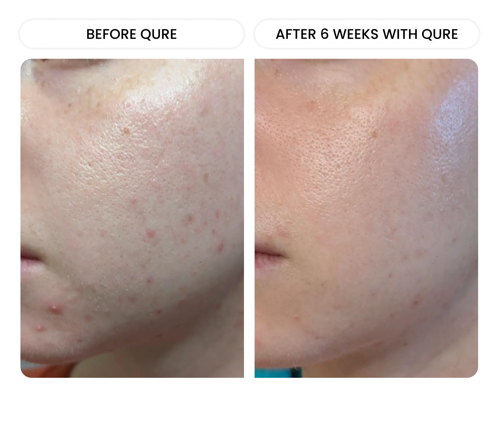 All-In-One Face Serum