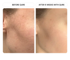 All-In-One Face Serum
